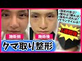 【整形】ずーっと気になってた"くま"をついに取ってきた【くま取り】【レポ】【コンプレックス】