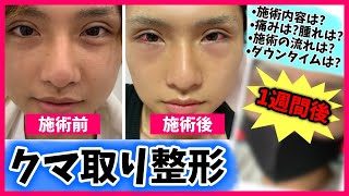 【整形】ずーっと気になってた"くま"をついに取ってきた【くま取り】【レポ】【コンプレックス】