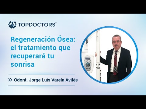Regeneración Ósea: el tratamiento que recuperará tu sonrisa
