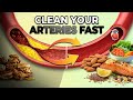 13 FOODS That Lower CHOLESTEROL & Clean Your ARTERIES Fast
