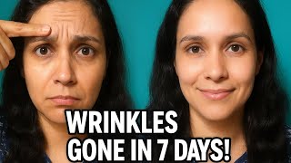 Forehead Wrinkles Remove Naturally | Face Yoga For Wrinkle Free Smooth Skin