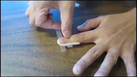 How to Clean your finger when you have a Mallet Finger Injury (Splint B)