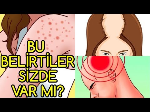 Vücudunda Bunlar EKSİKSE ENTERESAN BELİRTİLER Oluşabilir