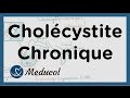 Cholcystite chronique calcul vsicule biliaire symptmes inflammation et cholcystectomie