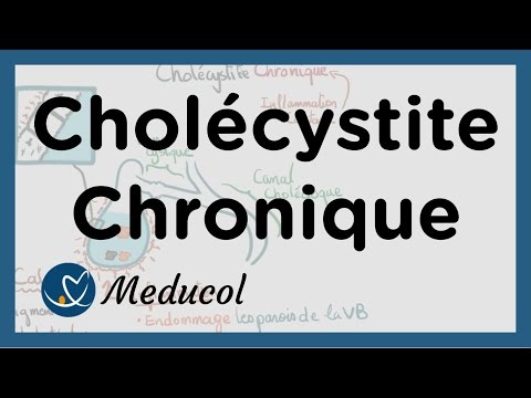 Vidéo: La cholédocholithiase peut-elle causer de la constipation ?