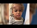 Concord daycare with state violations under microscope after toddler comes home with swollen face