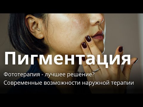 ВЕБИНАР: Пигментация. Фототерапия