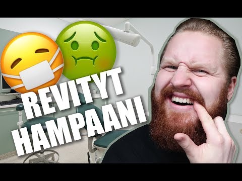 Video: Miksi Vedantan poistaminen epäonnistui?