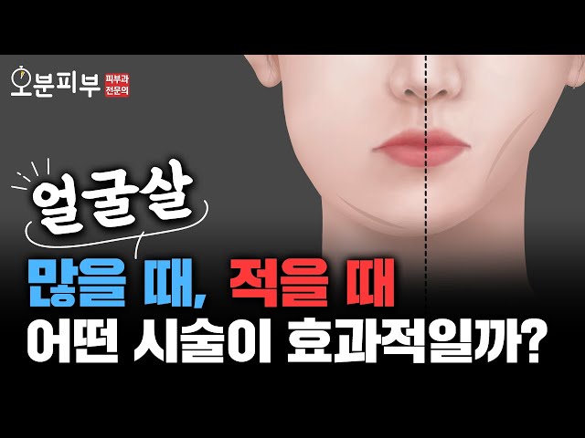 얼굴살 많거나 적은분들 꼭 보세요