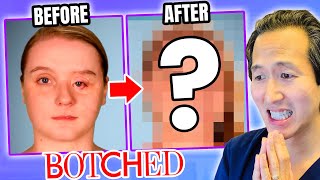 Plastic Surgeon Reacts to BOTCHED: Incredible Eye Reconstruction! by Doctor Youn 75,806 views 10 days ago 8 minutes, 21 seconds