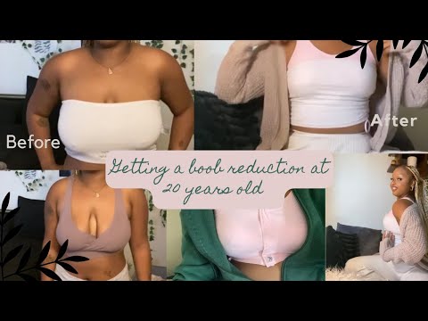 Getting a boob reduction at 20 years old! 40DD to a small B!