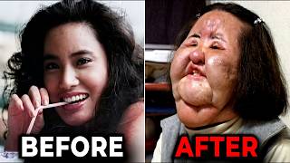 10 Celebrity Beauty Procedures That Backfired Badly