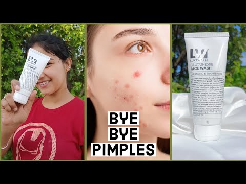 glutathione pimples Does Make You Break Out? Understanding the Connection Between Glutathione and Acne Glutathione Capsules and Isotretinoin: Safe