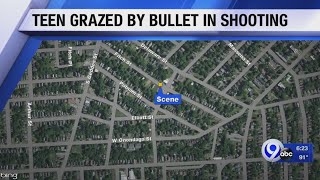 18-year-old grazed by bullet