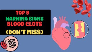 Unlocking the Top 9 Warning Signs of Blood Clots: Protect Your Health Today