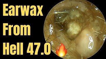 Earwax From Hell 47.0 🔥