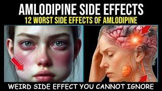 12 Worst Side Effects of Amlodipine You Should NEVER Ignore!