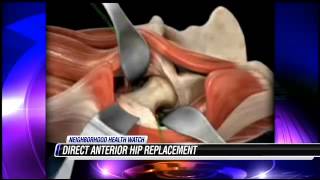 HCA Neighborhood Health Watch - Hip Replacement