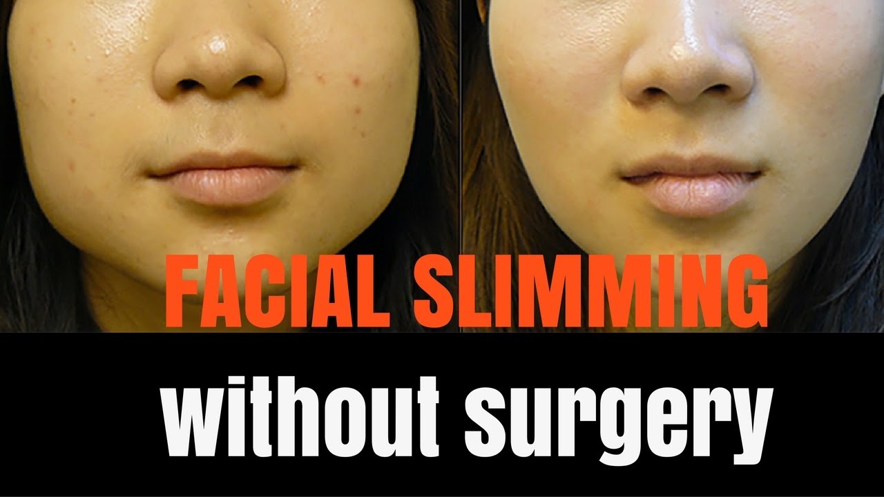 slimming facial