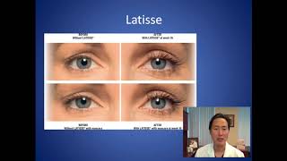 How Can I Make My Eyelashes Thicker and Longer - Latisse Consultation - Dr. Anthony Youn