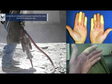 iasgroup Hydrodemolition - Safe Removal of Concrete