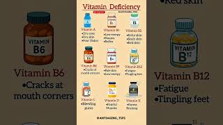 Vitamin Deficiency Symptoms You Should Never Ignore | USA Health Guide Tips #vitaminddeficiency