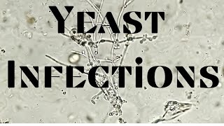Yeast Infections: Symptoms, Diagnosis, Treatment screenshot 2