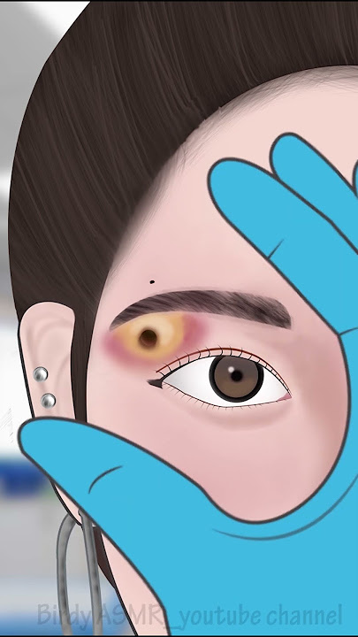 ASMR Infected Eyebrow piercing removal#asmr #animation #viral #trending #shorts