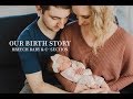 OUR BIRTH STORY: BREECH BABY C SECTION RECOVERY - POSITIVE EXPERIENCE