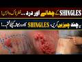 Suffering from Shingles Pain? Discover Modern Pain Management & Nerve Treatment Solutions