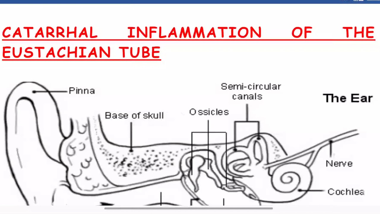 Presentation of Eustachian tube congestion in brief YouTube