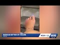 Woman bitten by baby shark in Naples shares safety reminder