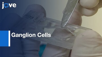 Dynamic Clamp Implementation with Conductances in Ganglion Cells | Protocol Preview