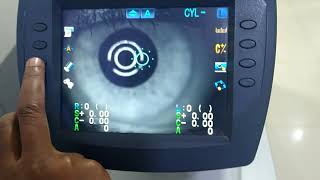 principle of Auto refractometer in Tamil #working principal #advantages disadvantage# AR principle