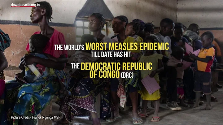 Health: Worst measles epidemic has hit the Democratic Republic of Congo killing over 6,000 people