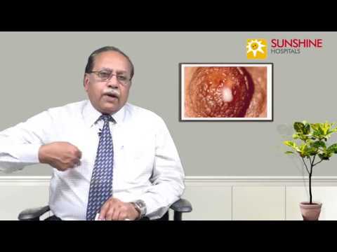 Watch Dr. C. S. Indra Mohan, Consultant General Surgeon, talk about Breast nipple discharge