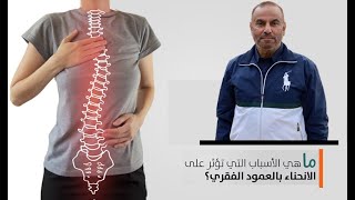 شئ خطير يجب معرفته جيداً حتي تقي نفسك من انحناء العمود الفقري مع زيادة العمر