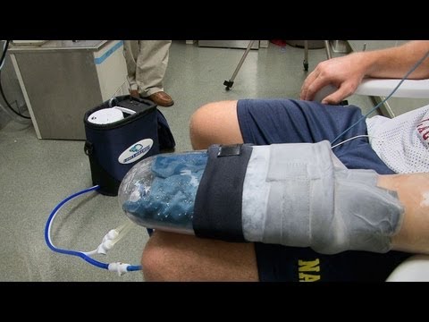 Stanford Researchers' Cooling Glove Boosts Exercise Recovery