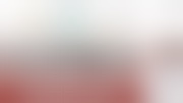 How 360° Liposuction Creates Perfect Curves | Marking + Planning | Dr Amit Gupta