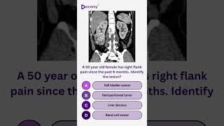 🔔 Before You Scroll — Try This MCQ #neetpg #mbbs #inicet