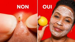 Voici Le Masque Œuf Citron Qui ARRACHE Tous Les Points Noirs Après 45 Ans