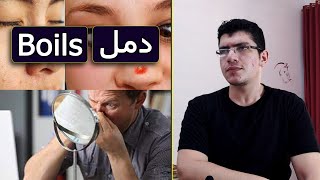 Boils | 5 طرق سريعة للتخلص من الدمامل على الجلد ⏰