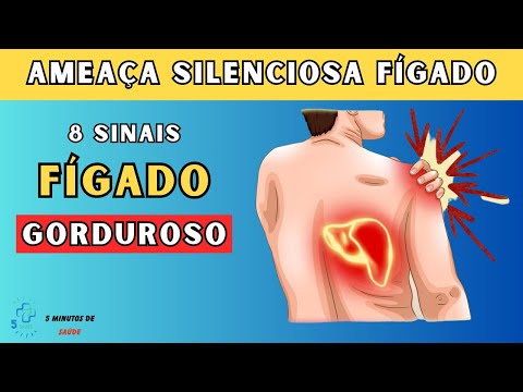 AMEAÇA SILENCIOSA: 8 sinais que podem indicar doença hepática gordurosa