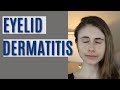 EYELID DERMATITIS| SKIN CARE Q&A WITH DERMATOLOGIST DR DRAY