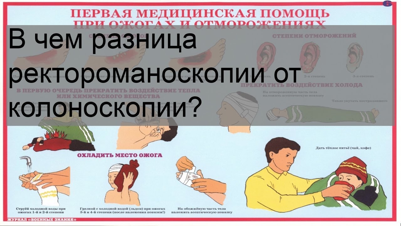 В чем разница ректороманоскопии от колоноскопии?