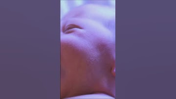 New Born Jaundice:Causes,Treatment & Precautions!