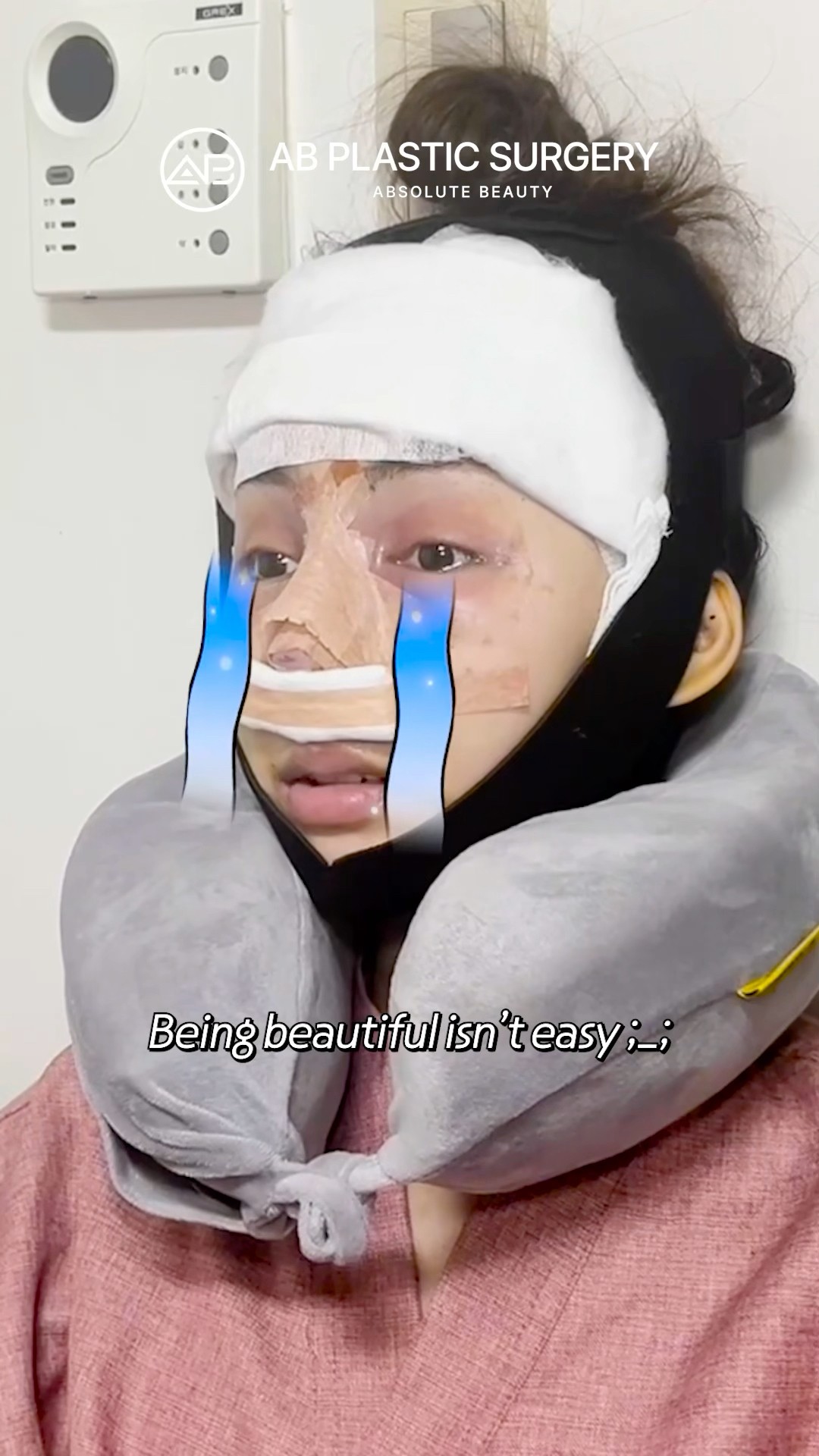 She Traveled to Korea for Plastic Surgery #koreanplasticsurgery