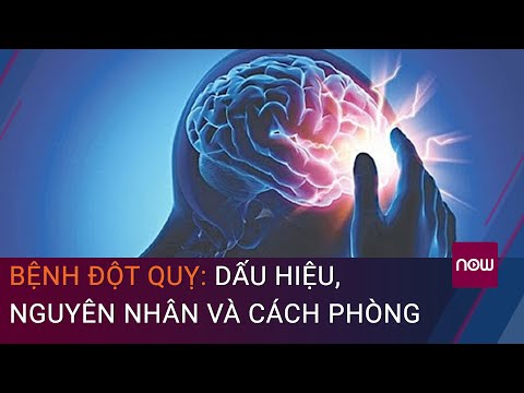 Video: Làm thế nào để xác định một người nào đó bị đột quỵ: 6 bước (có hình ảnh)