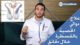 Dr Hamza BENJELLOUN | علاج دوالي الخصية بدون جراحة: القسطرة لنتائج فعالة  | الدكتور حمزة بنجلون