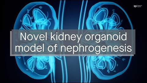 Development and implementation of a new kidney organoid model of nephrogenesis